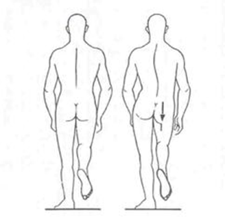 Zdroj: https://is.muni.cz/do/fsps/e-learning/ztv/pages/04-diagnostika-text.html